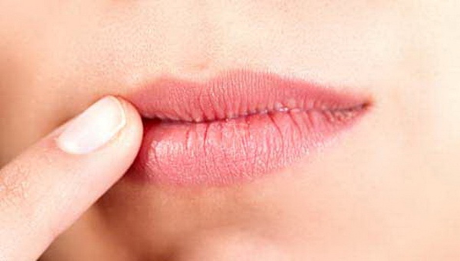 Чем лечить потрескавшиеся губы